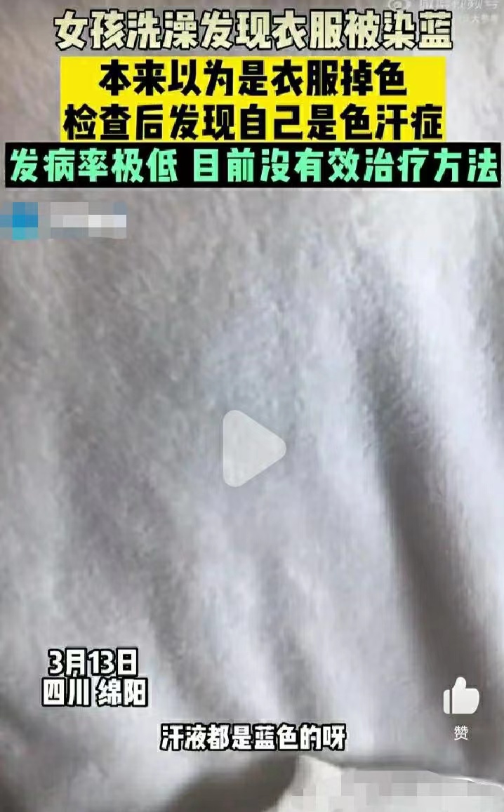 人出汗把衣服染成蓝色？竟是患有色汗症